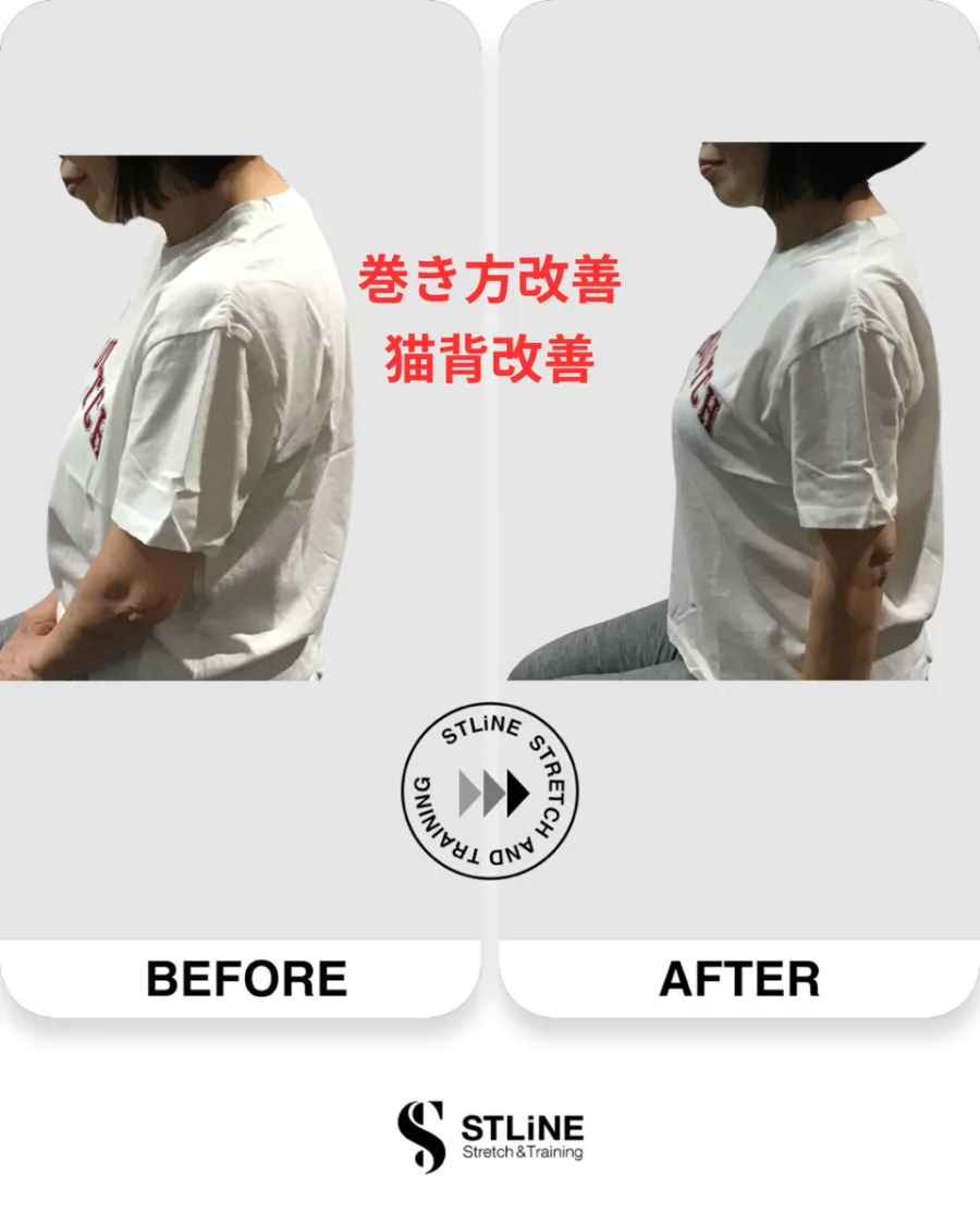 お客様のビフォーアフター(巻き肩改善・猫背改善)